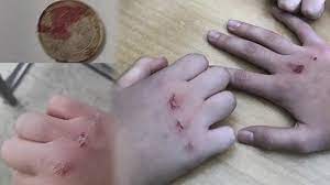 Anneler bozuk paralara dikkat!