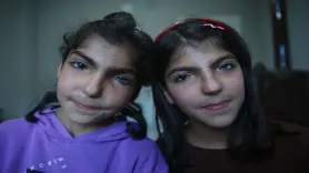 Farklı göz renkleri olan kız kardeşler görenleri şaşırtıyor