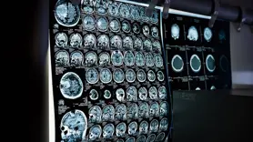 Türkiye'de geçen yıl 2 milyon 700 bin kolorektal kanser taraması yapıldı