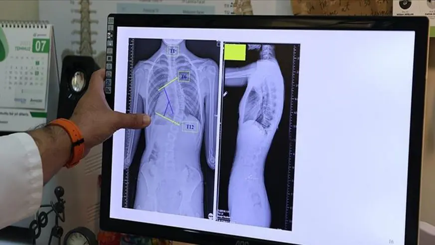 Uzmanından omurga sağlığı uyarısı