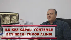 İlk kez kapalı yöntemle beyindeki tümör alındı