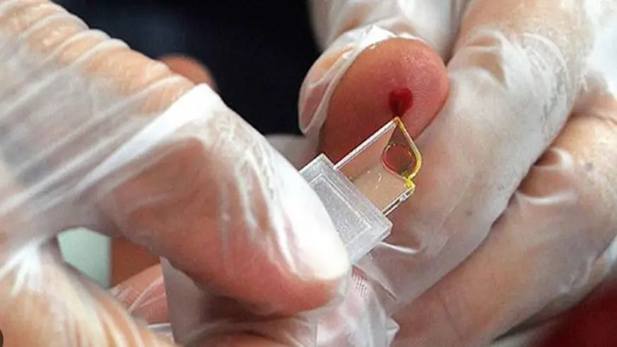 Kan gruplarının kanser üzerindeki etkisi araştırıldı